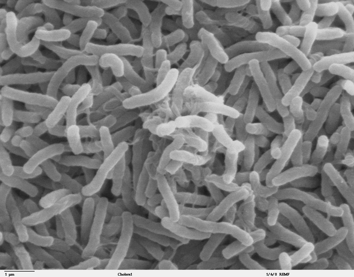 Cholera bacteria SEM